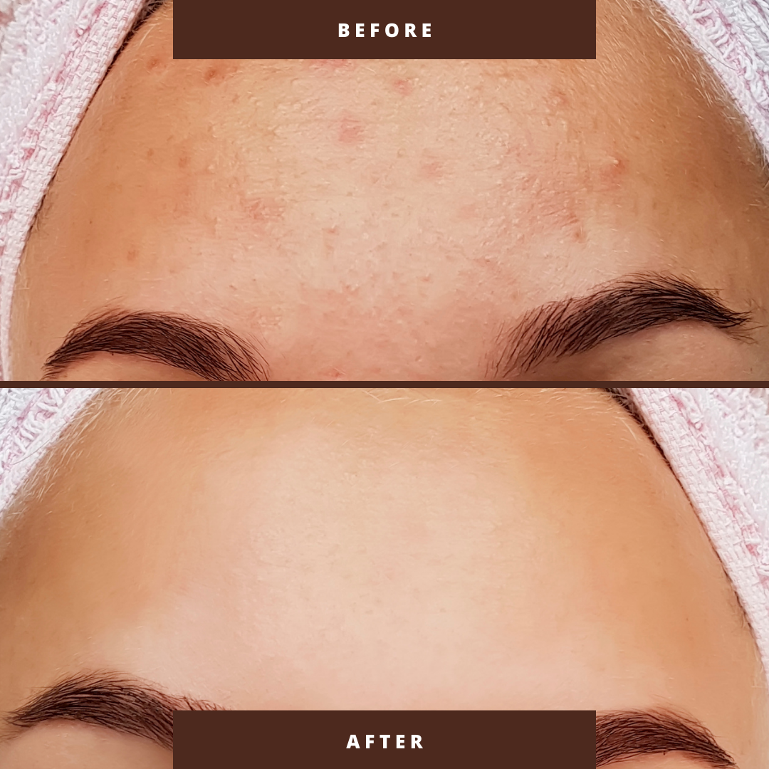 Organic Coffee facial and body scrub - Image 3